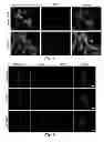 Fig. 09 - Theranostic nanoparticle and methods for making and using the nanoparticle