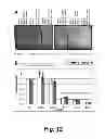 Fig. 09 - Method for Improving Penetration or Long Term Adhesion of Compositions to Dental Tissues and Compositions Usable in Said Method