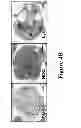 Fig. 06 - NOVEL BISAMINOQUINOLINE COMPOUNDS, PHARMACEUTICAL COMPOSITIONS PREPARED THEREFROM AND THEIR USE