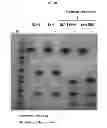 Fig. 25 - ULTRALONG COMPLEMENTARITY DETERMINING REGIONS AND USES THEREOF