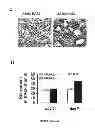 Fig. 09 - Compositions and methods for the treatment of tissue fibrosis