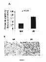 Fig. 28 - Compositions and methods for the treatment of tissue fibrosis