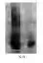Fig. 22 - Inactivated bacterial cell formulation