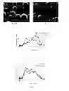 Fig. 02 - Risperidone sustained release microsphere composition