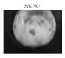 Fig. 06 - Aluminum precursor composition