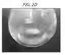 Fig. 07 - Aluminum precursor composition