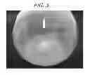 Fig. 08 - Aluminum precursor composition