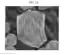 Fig. 03 - Positive active material for rechargeable lithium battery, method for preparing same and rechargeable lithium battery including same