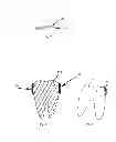 Fig. 03 - COATING FOR A DENTAL MATRIX BAND