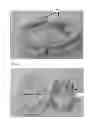 Fig. 04 - Modeling and manufacturing the superstructure for a denture