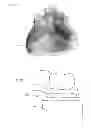 Fig. 10 - Modeling and manufacturing the superstructure for a denture