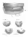 Fig. 14 - Modeling and manufacturing the superstructure for a denture