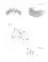 Fig. 15 - Modeling and manufacturing the superstructure for a denture
