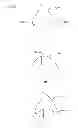 Fig. 16 - Modeling and manufacturing the superstructure for a denture