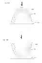 Fig. 18 - Modeling and manufacturing the superstructure for a denture