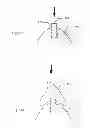 Fig. 22 - Modeling and manufacturing the superstructure for a denture