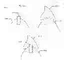 Fig. 23 - Modeling and manufacturing the superstructure for a denture