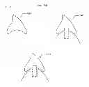 Fig. 24 - Modeling and manufacturing the superstructure for a denture