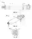 Fig. 03 - Method of creating an accurate bone and soft-tissue digital dental model