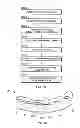 Fig. 06 - Method of creating an accurate bone and soft-tissue digital dental model