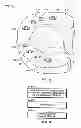 Fig. 14 - Method of creating an accurate bone and soft-tissue digital dental model