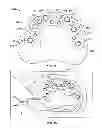 Fig. 16 - Method of creating an accurate bone and soft-tissue digital dental model