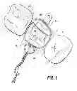 Fig. 02 - Scanning polymerization of dental material