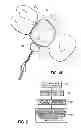 Fig. 07 - Scanning polymerization of dental material