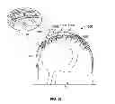 Fig. 17 - SYSTEMS AND METHODS TO GATHER AND ANALYZE ELECTROENCEPHALOGRAPHIC DATA