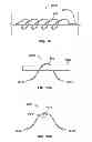 Fig. 20 - SYSTEMS AND METHODS TO GATHER AND ANALYZE ELECTROENCEPHALOGRAPHIC DATA