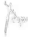 Fig. 35 - SYSTEMS AND METHODS TO GATHER AND ANALYZE ELECTROENCEPHALOGRAPHIC DATA