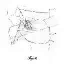 Fig. 08 - OSTOMY LEARNING ASSEMBLIES, KITS, AND METHODS OF MAKING AND USING
