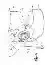 Fig. 09 - OSTOMY LEARNING ASSEMBLIES, KITS, AND METHODS OF MAKING AND USING