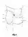 Fig. 11 - OSTOMY LEARNING ASSEMBLIES, KITS, AND METHODS OF MAKING AND USING