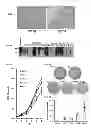 Fig. 04 - Methods for detecting hepatitis B virus surface gene non-sense mutations