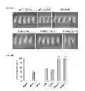 Fig. 05 - Methods for detecting hepatitis B virus surface gene non-sense mutations