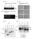 Fig. 06 - Methods for detecting hepatitis B virus surface gene non-sense mutations