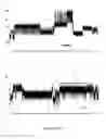 Fig. 11 - CONTROL OF DNA MOVEMENT IN A NANOPORE AT ONE NUCLEOTIDE PRECISION BY A PROCESSIVE ENZYME