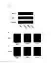 Fig. 05 - METHOD OF JUDGING INFLAMMATORY DISEASE BY USING SINGLE NUCLEOTIDE POLYMORPHISM