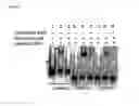 Fig. 07 - Identification of gene associated with reading disability and uses therefor