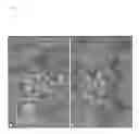 Fig. 02 - Methods of isolating non-senescent cardiac stem cells and uses thereof
