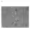 Fig. 04 - Methods of isolating non-senescent cardiac stem cells and uses thereof