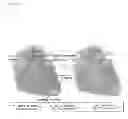 Fig. 37 - Methods of isolating non-senescent cardiac stem cells and uses thereof