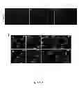 Fig. 18 - DIRECT REPROGRAMMING OF HUMAN FIBROBLASTS TO FUNCTIONAL NEURONS UNDER DEFINED CONDITIONS