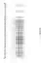 Fig. 05 - High level expression of recombinant toxin proteins
