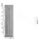 Fig. 41 - High level expression of recombinant toxin proteins