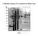 Fig. 04 - MICROBIAL ENHANCED OIL RECOVERY METHODS