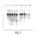 Fig. 04 - Method and medicament for inhibiting the expression of a given gene