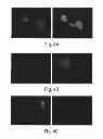 Fig. 05 - Method and medicament for inhibiting the expression of a given gene