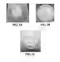 Fig. 02 - Three dimensional cell culture compositions and methods of use